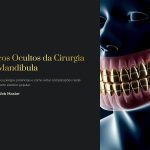 1 Riscos Ocultos da Cirurgia de Mandibula